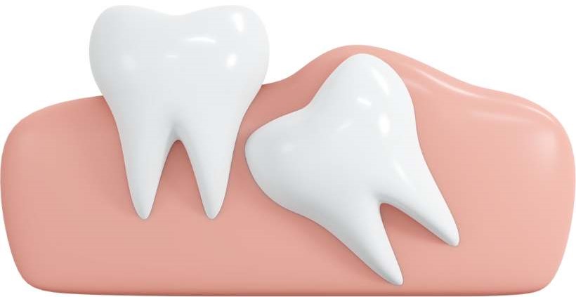 Connecting Wisdom Teeth To The Concept Of Gaining New Insights And Understanding: Connection Of Wisdom Teeth
