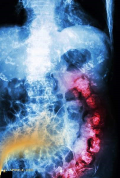 Emotional causes of constipation