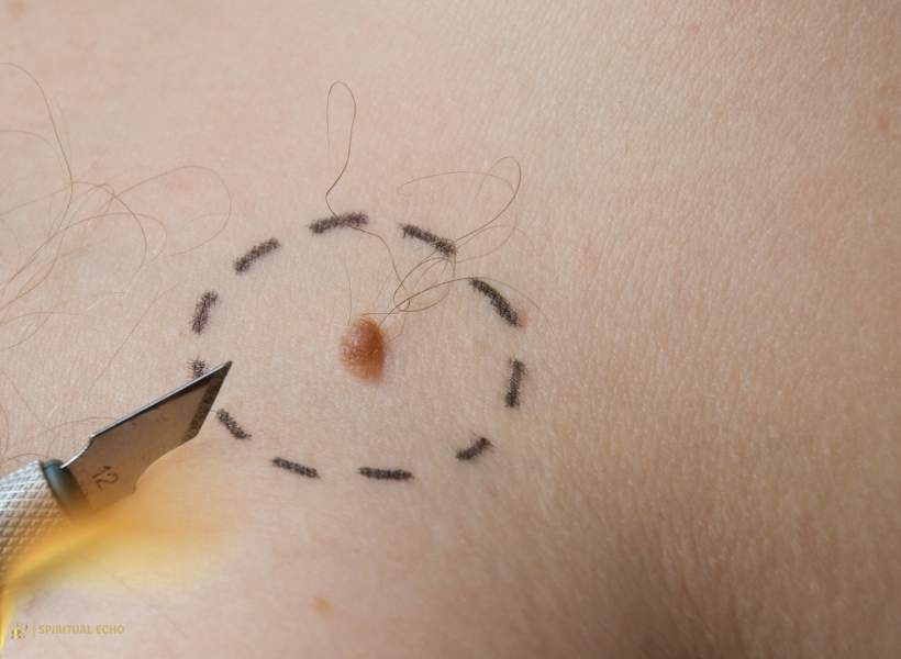 Sacral Dimples In Astrology And Birth Marks