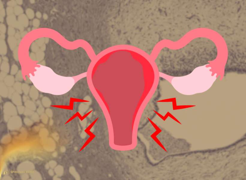 Spiritual And Emotional Roots Of Endometriosis